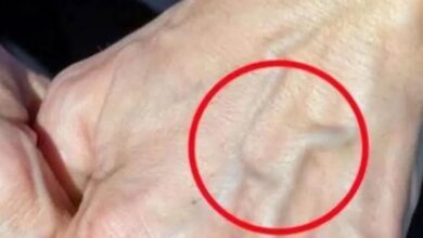 What Visible Veins on Your Hands Can Mean