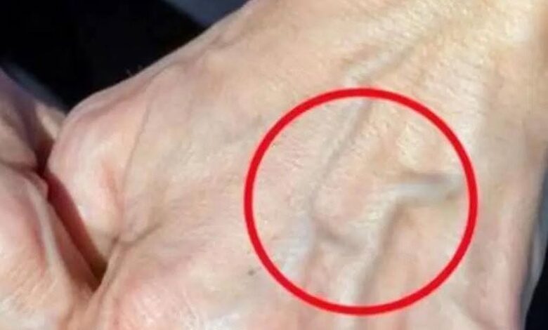 What Visible Veins on Your Hands Can Mean